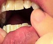 Mouth Vore Close Up Of Fifi Foxx Eating Gummy Bears from skype群发代拉营销软件认准熊猫tgssk1866智能筛选软件认准熊猫tgssk1866 wni