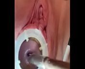 Watch 8mm electrosound puckering my cervix as I squeal from from mm col
