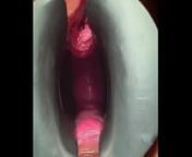 G-spot fucking via urethra from cid sheya and pw keerthi reddy nude sex photos