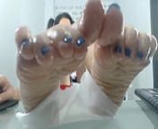 Sam's Blue Toes & Oily Soles from aunty oily soles feet