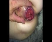 Anal dildo prolapse squirt big ass from bigg cock se