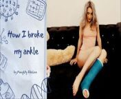 How I broke my ankle by Naughty Adeline from sprain crutching girlfrient