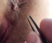 This is what happens when you ask your husband to help you remove the hair around the anus... from cute indian shaving hairy pussy with rezor mms 3gp