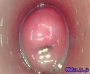 Masturbation with camera inside the pussy - endoscope version - teaser - xxs pie from rosy fumetto